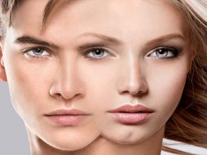 Male-to-Female-Sex-change-Surgery