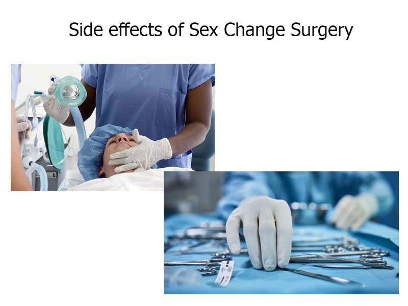 Side effects of Sex Change Surgery