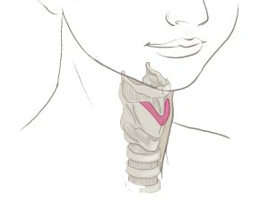 All about Chondrolaryngoplasty